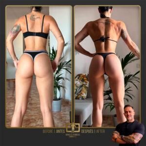 conchi_antes_despues_1